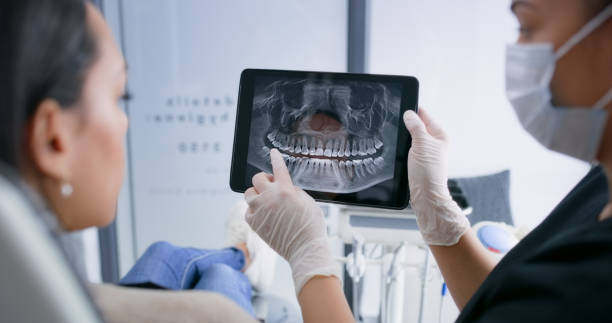 Licensed Teeth Whitening service in Runge, TX - Smile Center Dentistry